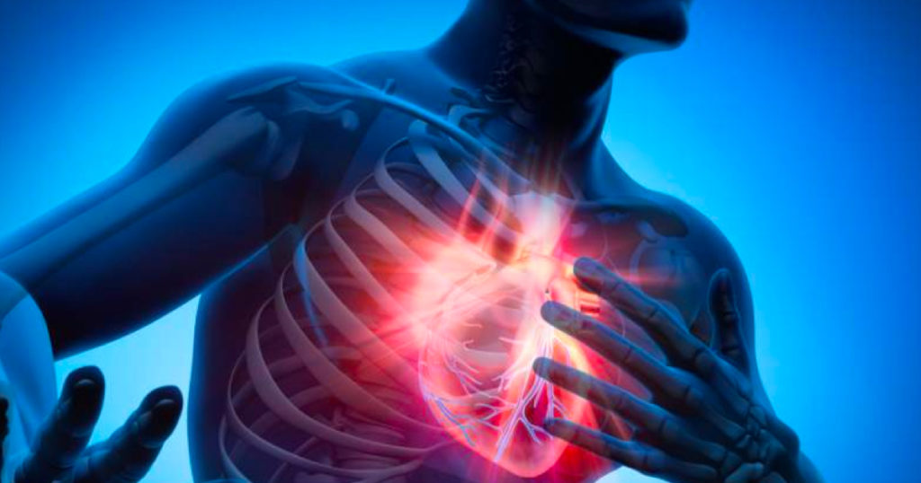 Sleep Apnea: Does It Affect the Heart?  Caribbean Sleep Apnea Solutions -  ISD Health Solutions